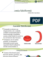 Anemia falciformă