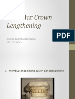 Prosedur Crown Lengthening