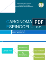 Carcinomaespinocelular 120308092017 Phpapp01