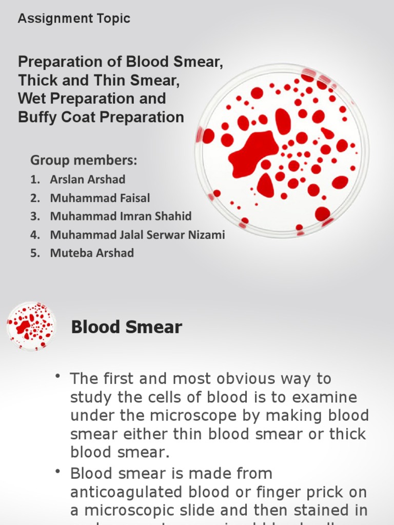 Blood Smear Preparation Techniques | PDF | Body Fluids | Hematology
