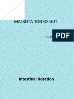 Malrotation of Gut: Pravin Narkhede