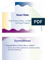 ECG Fast and Easy PP