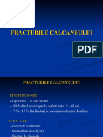 Fracturile de Calcaneu