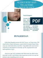 Alergi Susu Sapi vs Lactose Intolerance