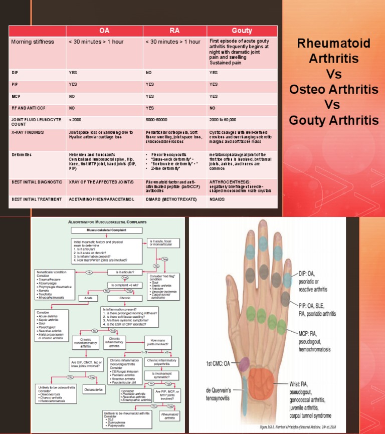 Rheumatoid Arthritis Vs Osteo Arthritis Vs Gouty Arthritis PDF Rheumatoid Arthritis Arthritis