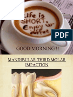 3rd Molar Impaction