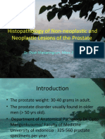Histopathology of Non-Neoplastic and Neoplastic Lesions of The Prostate