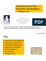 Chapter 13 - Cardiac Arrhythmias and Their Electrocardiographic Interpretation
