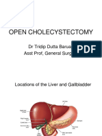 Open Cholecystectomy: DR Tridip Dutta Baruah Asst Prof, General Surgery