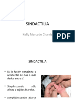 SINDACTILIA