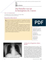 05.012 Caso Clínico. Varón de 64 Años Fumador Con Tos y Expectoración Hemoptoica de 2 Meses de Evolución