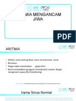 aritmia mengancam jiwa