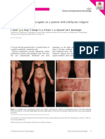 Disseminated Tinea Incognita in A Patient With Ichthyosis Vulgaris and Eczema