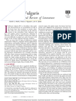 Ichthyosis Vulgaris: A Case Report and Review of Literature