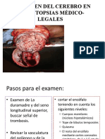 El Examen Del Cerebro en Las Autopsias Médico-Legales
