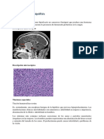 PROLACTINOMA Y CRANEOFARINGIOMA