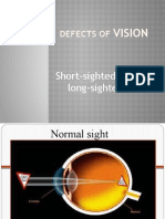 Defects of Vision