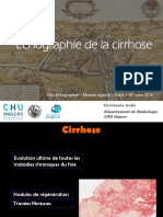 DIUE2016m1-Cirrhose_Ch-Aube
