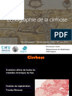 DIUE2016m1 Cirrhose - CH Aube