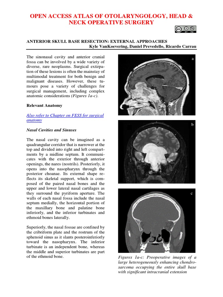Anterior Skull Base Resection Approaches | PDF | Human Nose | Skull