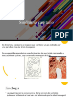 Síndrome cavitario: causas, síntomas y hallazgos de las cavidades pulmonares