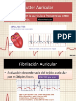 Flutter Auricular a Fibrilación Ventricular