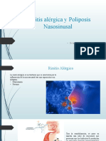 Rinitis Alérgica y Poliposis Nasosinusal