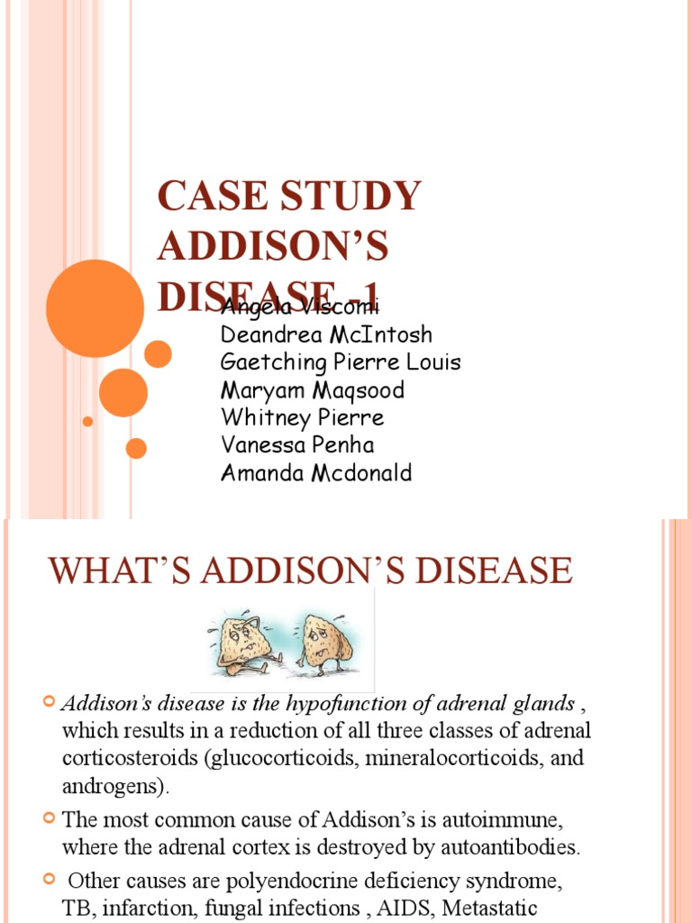addison's disease case study scribd