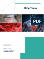 Hiperemia