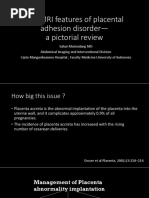 The MRI Features of Placental Adhesion Disorder—