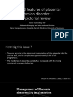 The MRI Features of Placental Adhesion Disorder