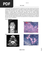 Download Salivary Glands by sarguss14 SN4928660 doc pdf