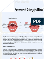 How-to-Prevent-Gingivitis.9465031.powerpoint