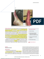 A Purpuric Rash: JAMA Clinical Challenge