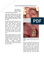 Lesi Vesikulobulosa Oral Yang Berhubungan Dengan Infeksi Sars