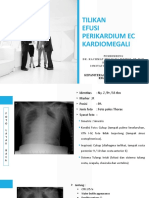 Tilikan Efusi Perikardium Ec Kardiomegali