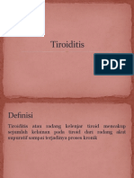 Tiroiditis