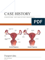 Unruptured Left Sided Ectopic Pregnancy