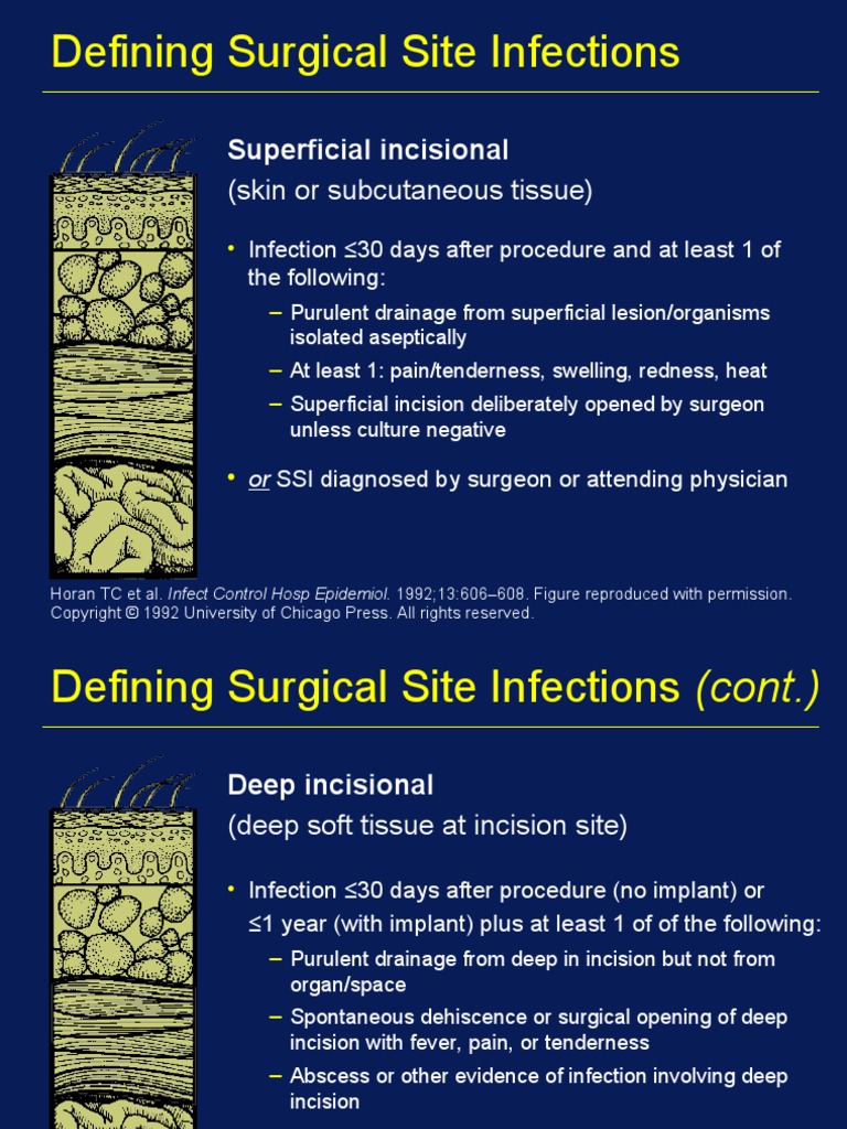Surgicalsite Infection | PDF | Surgery | Wound