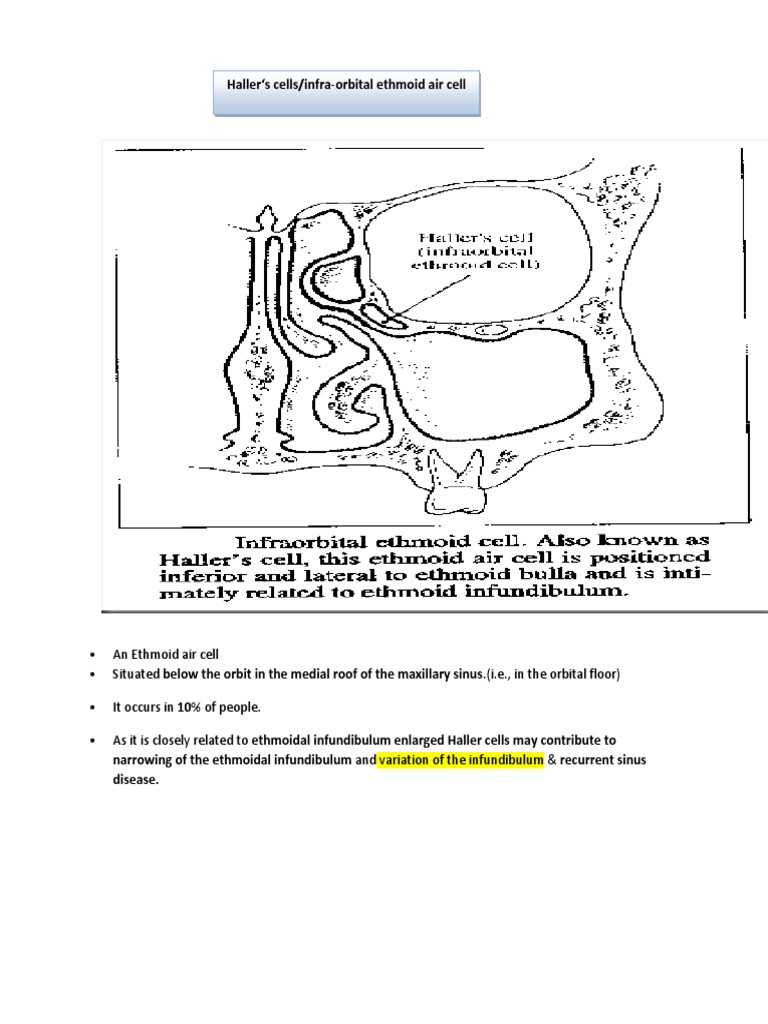 Haller S Cells/infraOrbital Ethmoid Air Cell PDF