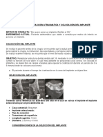 Protocolo de Colocación Del Implante Strauman