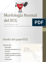 6. Morfología Normal Del ECG