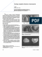 A Quick Method for Boxing Complete Denture Elastomeric