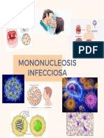 Moninucleosis
