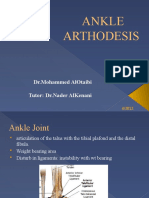 Ankle Arthodesis: DR - Mohammed Alotaibi Tutor: DR - Nader Alkenani