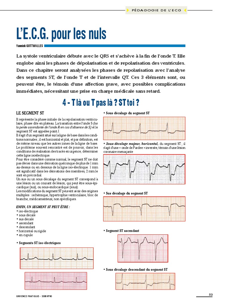 L'E.C.G. Pour Les Nuls - Partie4, PDF, Électrocardiographie