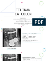 Tilikan CA Colon