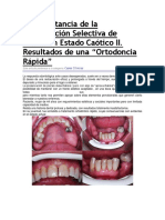 La Importancia de La Preservación Selectiva de Piezas en Estado Caótico II. Resultados de Una "Ortodoncia Rápida"