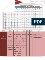 Lectura de Electrocardiograma-Raimarys Gomez