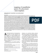 Tomographic Mapping of Mandibular Interr